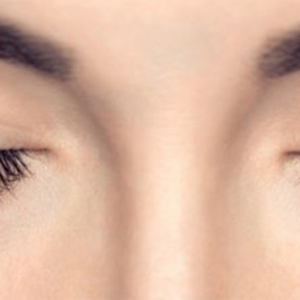 Magnetne Trepalnice slider